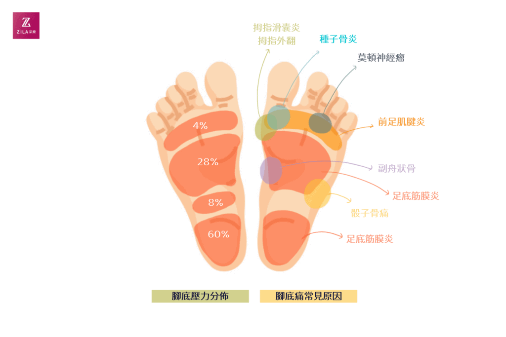 腳底痛常見原因