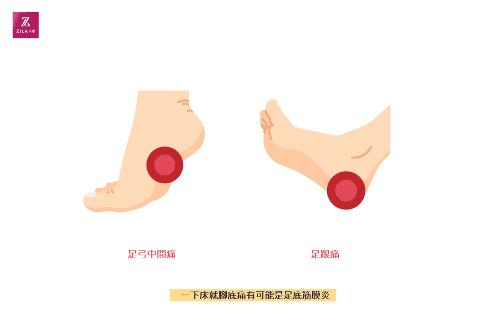 一下床腳底痛可能是足底筋膜炎