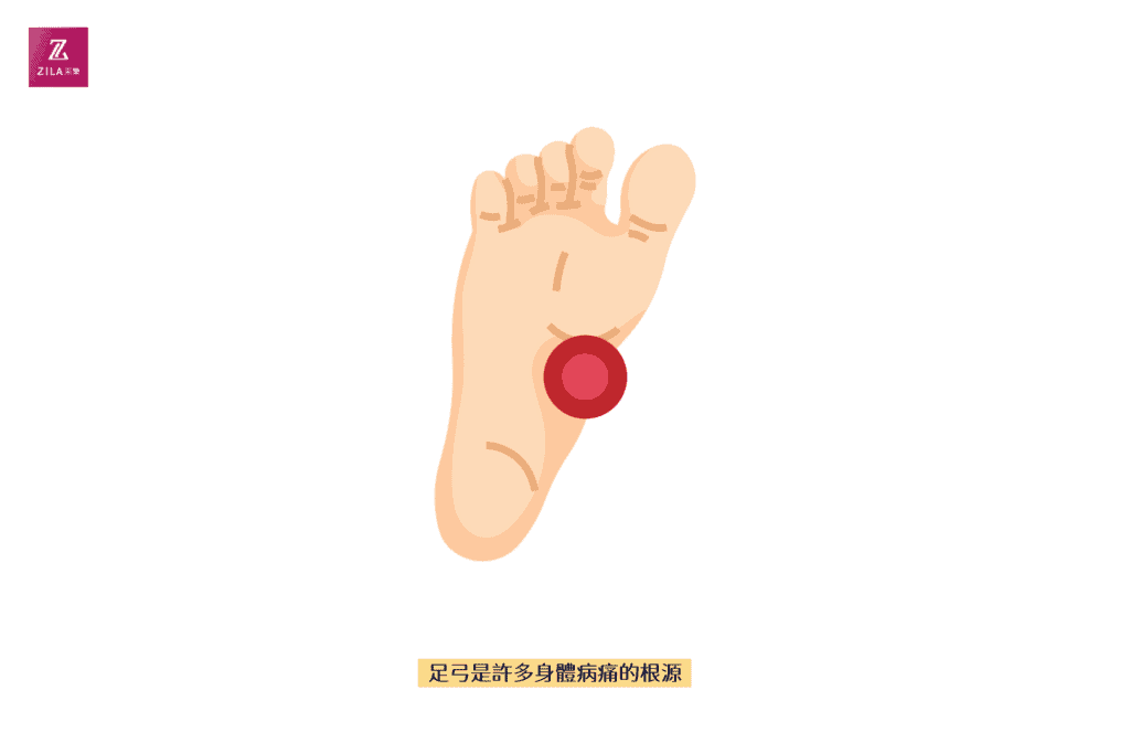 足弓是許多病痛的根源
