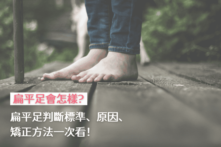 扁平足會怎樣？扁平足判斷標準、原因、矯正方法一次看！